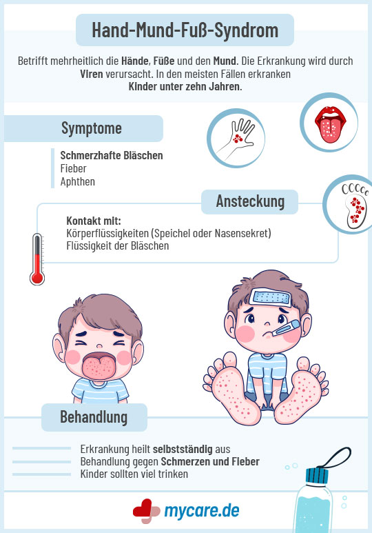 Infografik Hand-Mund-Fuß-Syndrom: Symptome, Ansteckung, Behandlung.