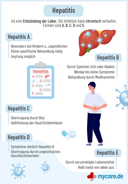 Infografik Hepatitis - Typen und Behandlung