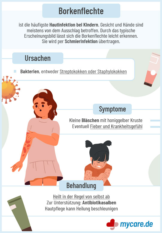 Infografik Borkenflechte: Ursachen, Symptome & Behandlung