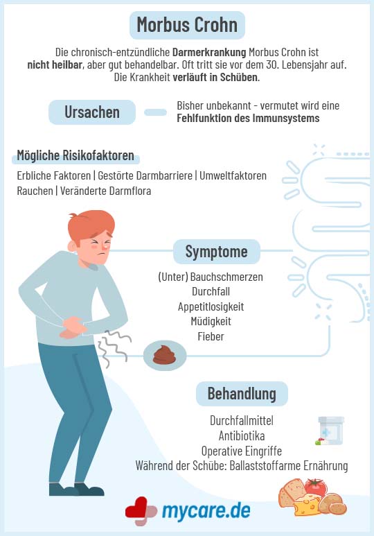 Infografik: Morbus Crohn - Vorbeugung, Symptome & Behandlung