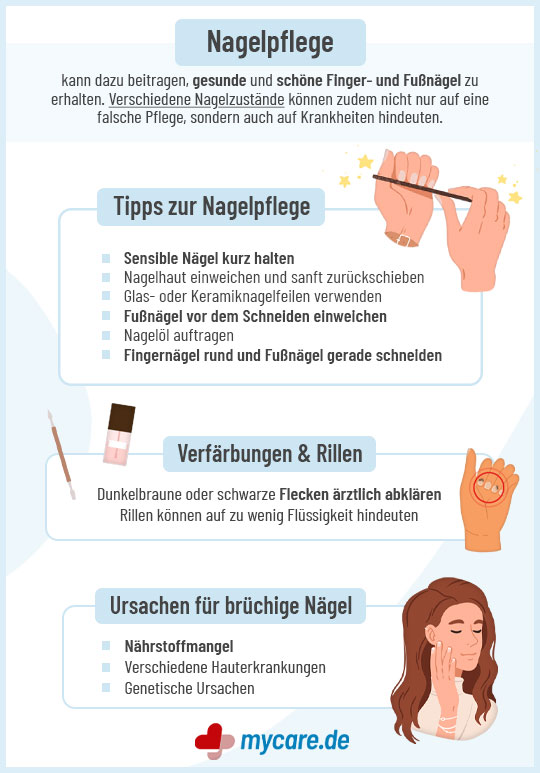 Infografik Nagelpflege: Tipps, Verfärbung, Rillen, Ursachen und Brüchige Nägel