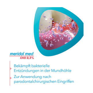 Grafik Meridol med CHX 0,2% Spülung Anwendungsgebiet