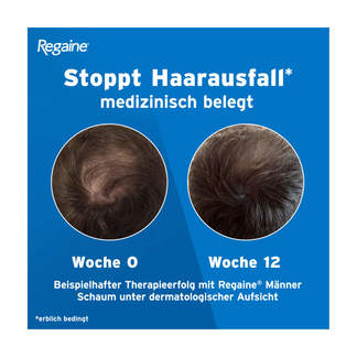 Grafik Regaine Männer Schaum Stoppt Haarausfall*