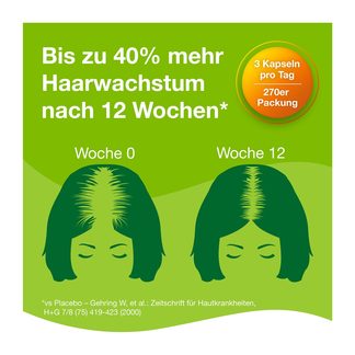 Grafik Priorin Kapseln bis zu 40% mehr Haarwachstum