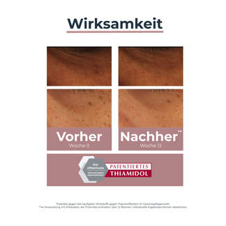 Grafik Eucerin Anti-Pigment Augenpflege Augenringe Wirksamkeit