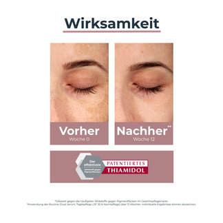 Grafik Eucerin Anti-Pigment Nachtcreme Wirksamkeit