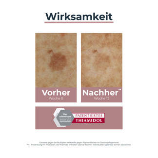 Grafik Eucerin Anti-Pigment Korrekturstift Wirksamkeit