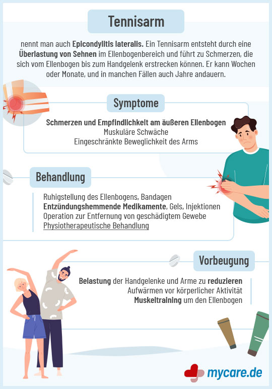 Infografik Tennisarm: Symptome, Behandlung & Vorbeugung